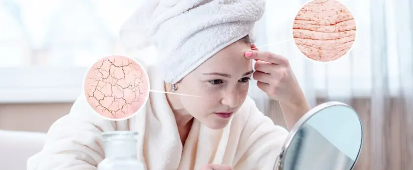 Skin Diseases Types, Symptoms, Treatment & Prevention